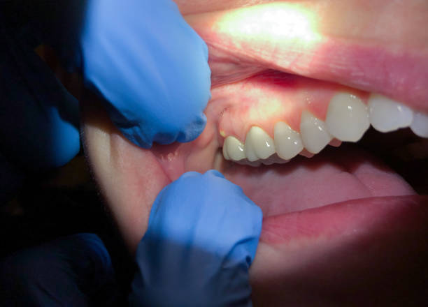 Best Pediatric Emergency Dentist in Kings Bay Base, GA